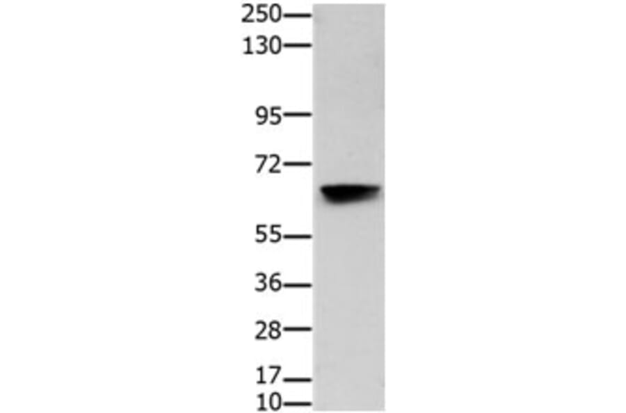 HDAC7 Antibody from Signalway Antibody (31217) - Antibodies.com
