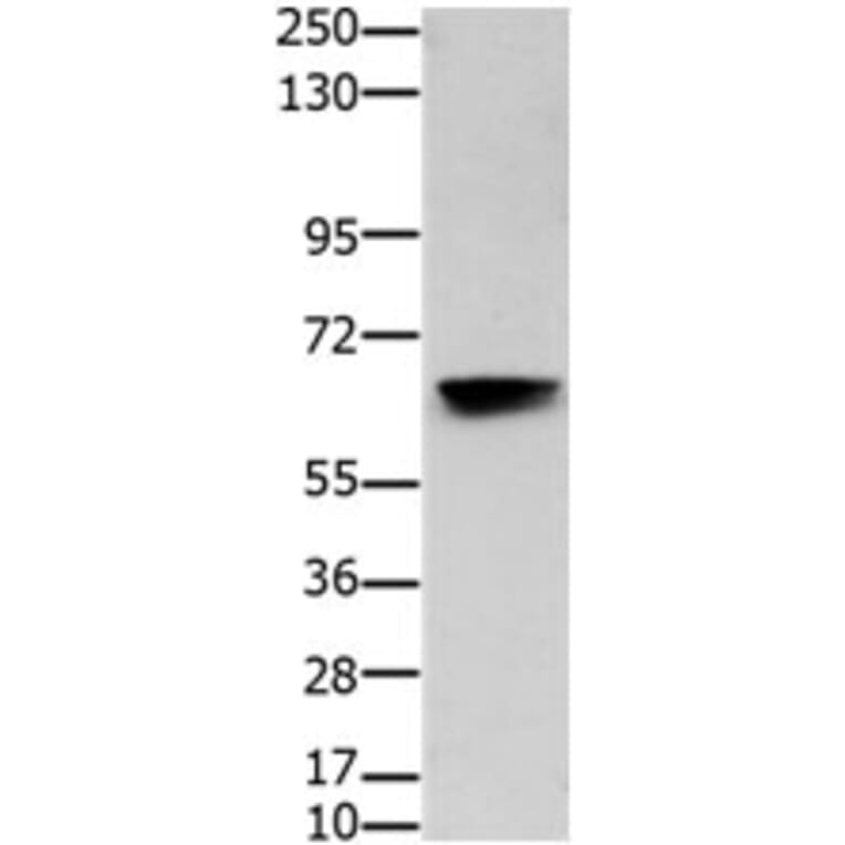 HDAC7 Antibody from Signalway Antibody (31217) - Antibodies.com