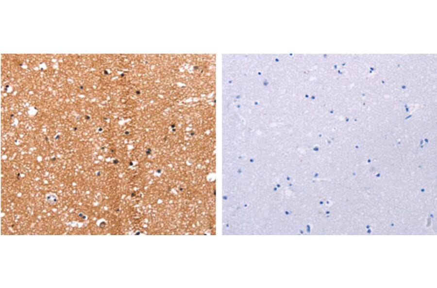 HDAC7 Antibody from Signalway Antibody (31217) - Antibodies.com