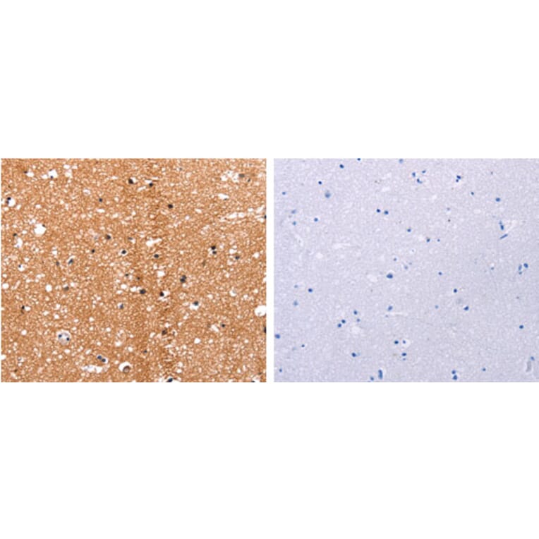 HDAC7 Antibody from Signalway Antibody (31217) - Antibodies.com