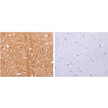 HDAC7 Antibody from Signalway Antibody (31217) - Antibodies.com