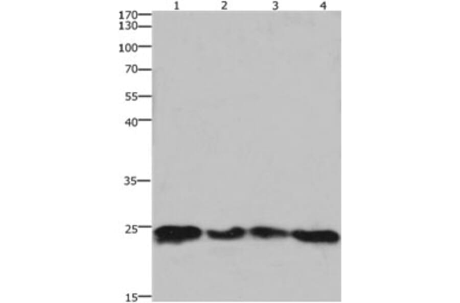 HMGB3 Antibody from Signalway Antibody (31220) - Antibodies.com