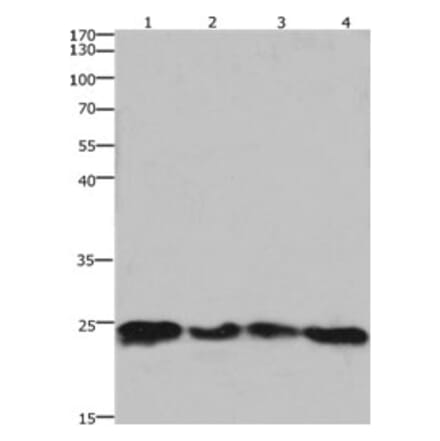 HMGB3 Antibody from Signalway Antibody (31220) - Antibodies.com