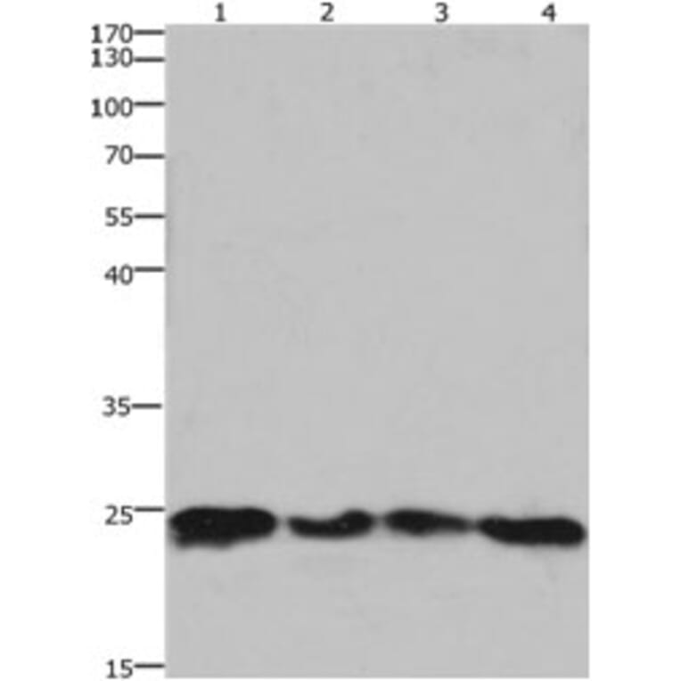 HMGB3 Antibody from Signalway Antibody (31220) - Antibodies.com