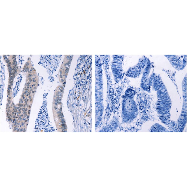 HMGB3 Antibody from Signalway Antibody (31220) - Antibodies.com