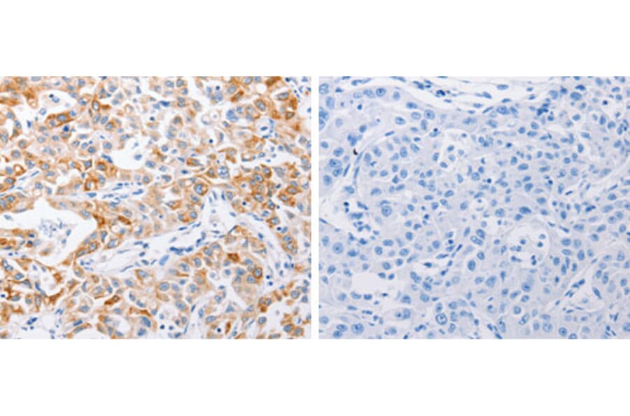 MMP10 Antibody from Signalway Antibody (31239) - Antibodies.com