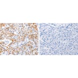 MMP10 Antibody from Signalway Antibody (31239) - Antibodies.com