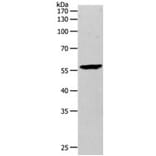MMP27 Antibody from Signalway Antibody (31242) - Antibodies.com