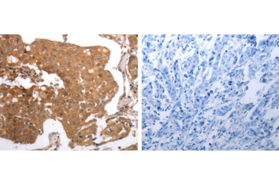 MMP27 Antibody from Signalway Antibody (31242) - Antibodies.com