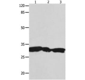 YWHAG Antibody from Signalway Antibody (31246) - Antibodies.com