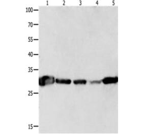 YWHAQ Antibody from Signalway Antibody (31247) - Antibodies.com