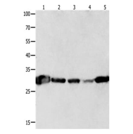YWHAQ Antibody from Signalway Antibody (31247) - Antibodies.com