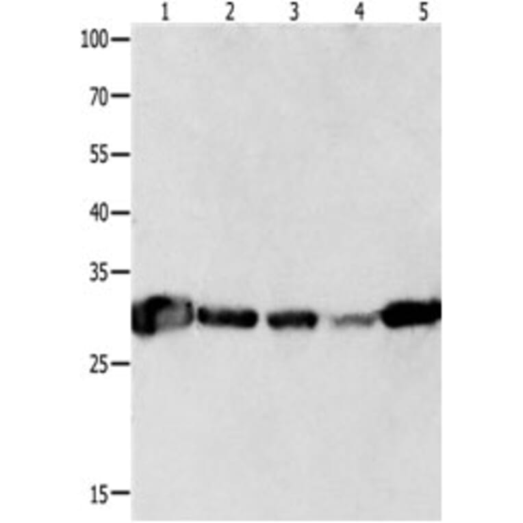 YWHAQ Antibody from Signalway Antibody (31247) - Antibodies.com