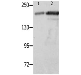 NPHS1 Antibody from Signalway Antibody (31249) - Antibodies.com