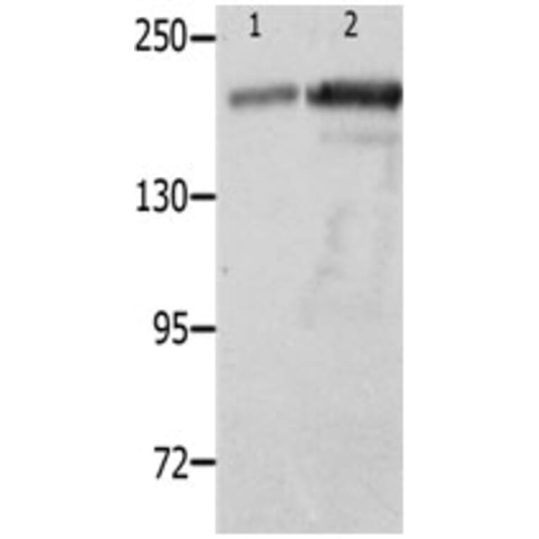 NPHS1 Antibody from Signalway Antibody (31249) - Antibodies.com