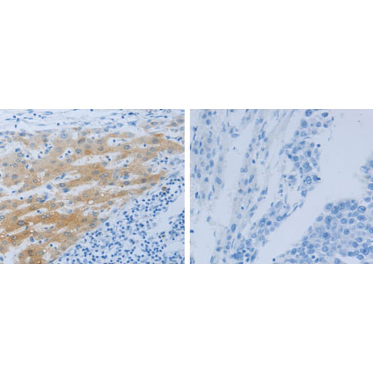 NPHS1 Antibody from Signalway Antibody (31249) - Antibodies.com