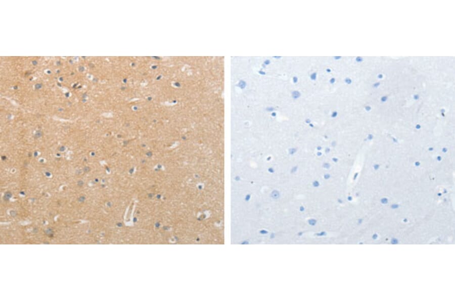 NFASC Antibody from Signalway Antibody (31250) - Antibodies.com