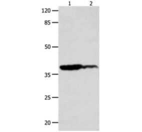 LPAR4 Antibody from Signalway Antibody (31253) - Antibodies.com
