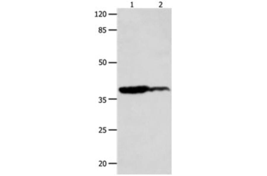 LPAR4 Antibody from Signalway Antibody (31253) - Antibodies.com