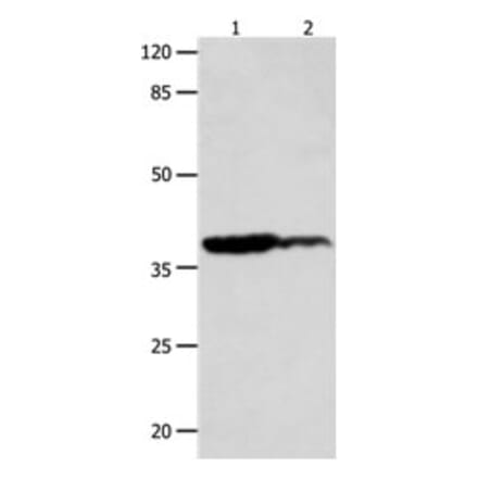 LPAR4 Antibody from Signalway Antibody (31253) - Antibodies.com