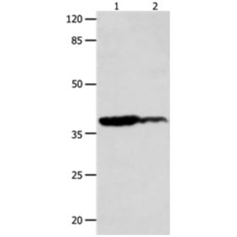 LPAR4 Antibody from Signalway Antibody (31253) - Antibodies.com