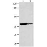 LPAR4 Antibody from Signalway Antibody (31253) - Antibodies.com