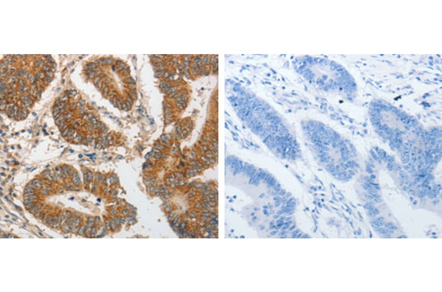 PIBF1 Antibody from Signalway Antibody (31261) - Antibodies.com