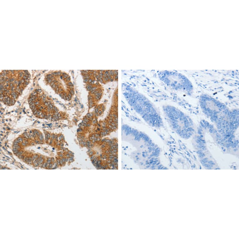 PIBF1 Antibody from Signalway Antibody (31261) - Antibodies.com