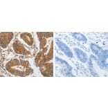PIBF1 Antibody from Signalway Antibody (31261) - Antibodies.com