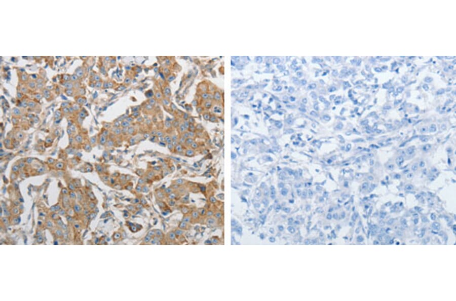 PRMT5 Antibody from Signalway Antibody (31262) - Antibodies.com