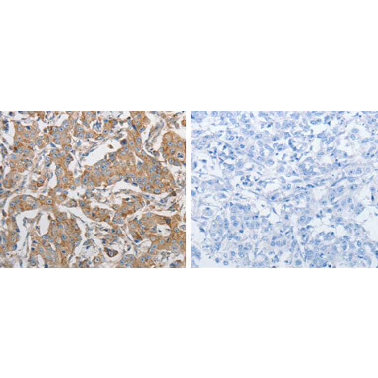 PRMT5 Antibody from Signalway Antibody (31262) - Antibodies.com