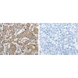 PRMT5 Antibody from Signalway Antibody (31262) - Antibodies.com