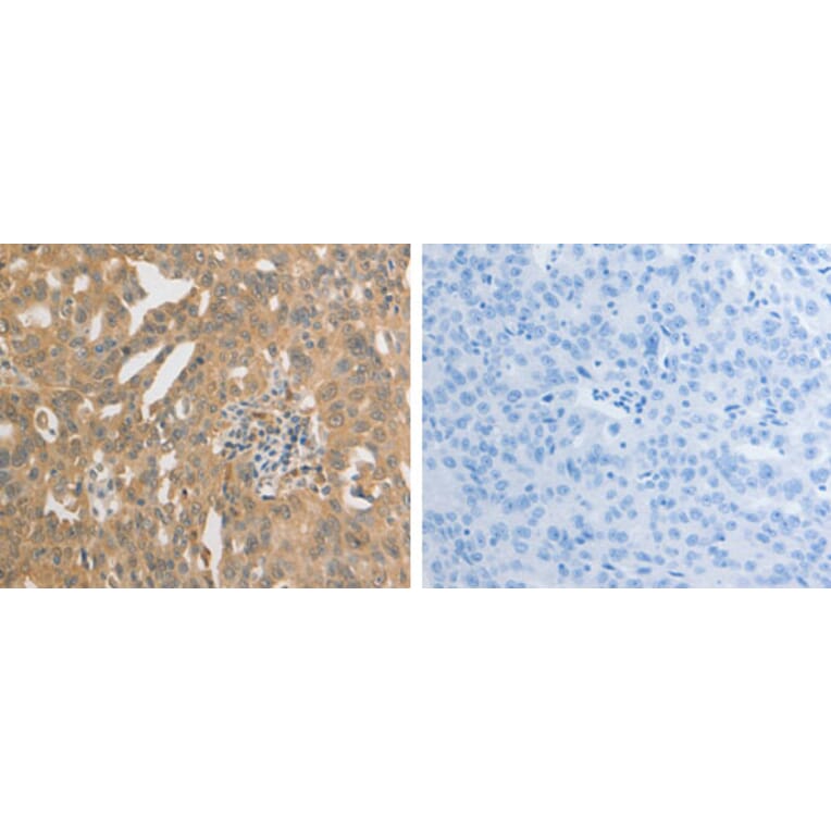 PRDX1 Antibody from Signalway Antibody (31263) - Antibodies.com