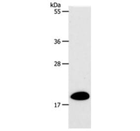 SIRT5 Antibody from Signalway Antibody (31267) - Antibodies.com