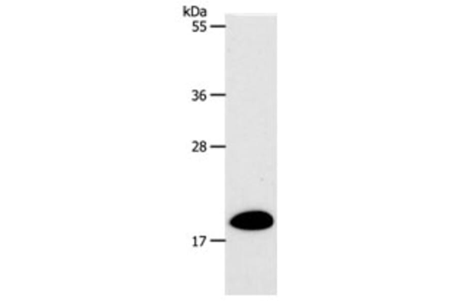 SIRT5 Antibody from Signalway Antibody (31267) - Antibodies.com