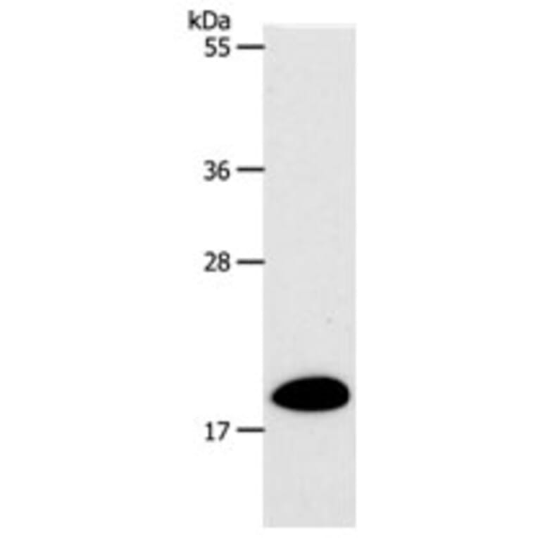 SIRT5 Antibody from Signalway Antibody (31267) - Antibodies.com