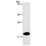 SIRT5 Antibody from Signalway Antibody (31267) - Antibodies.com