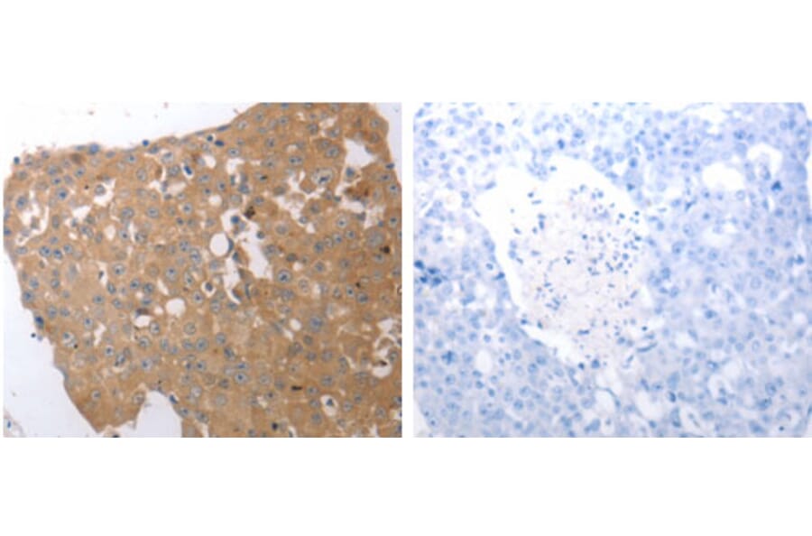 SIRT5 Antibody from Signalway Antibody (31267) - Antibodies.com