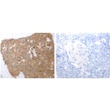 SIRT5 Antibody from Signalway Antibody (31267) - Antibodies.com