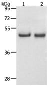 Gel: 12% SDS-PAGELane1: Hela cell lysateLane1: K562 cell lysate. Lysate: 40ug per lane. Primary antibody: 1/1100 dilution. Secondary antibody: Goat anti Rabbit IgG - H&L (HRP) at 1/10000 dilution. Exposure time: 30 seconds