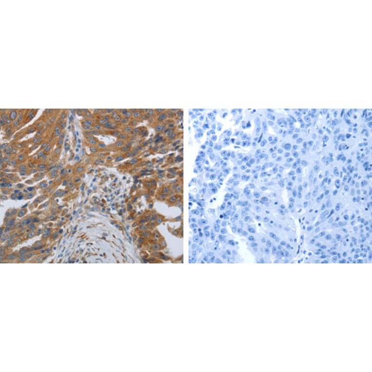 SPAG4 Antibody from Signalway Antibody (31271) - Antibodies.com