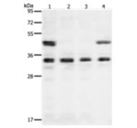 VEGFA Antibody from Signalway Antibody (31274) - Antibodies.com