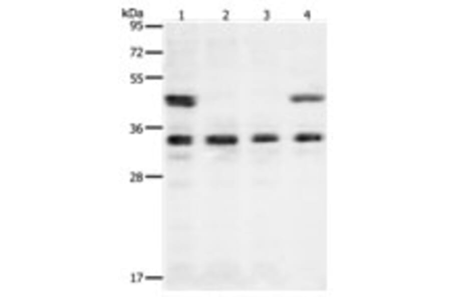 VEGFA Antibody from Signalway Antibody (31274) - Antibodies.com