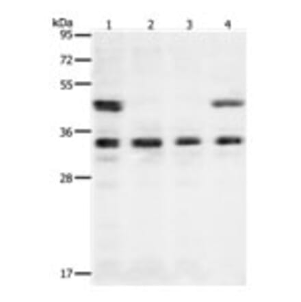 VEGFA Antibody from Signalway Antibody (31274) - Antibodies.com