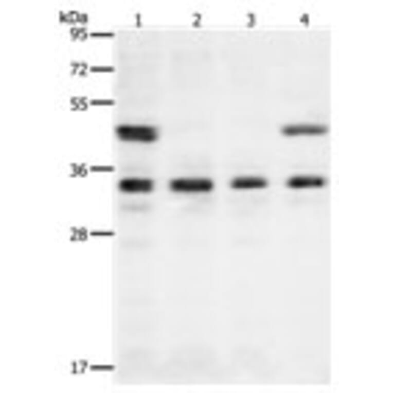 VEGFA Antibody from Signalway Antibody (31274) - Antibodies.com