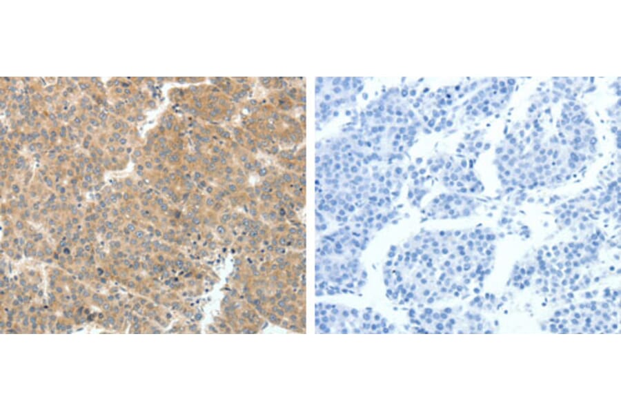 VEGFA Antibody from Signalway Antibody (31274) - Antibodies.com