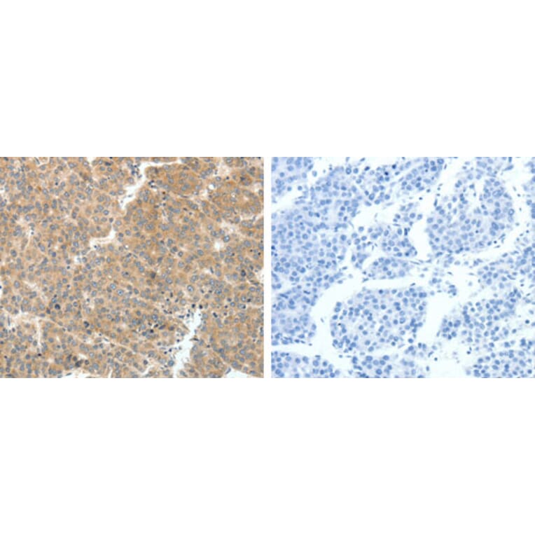 VEGFA Antibody from Signalway Antibody (31274) - Antibodies.com