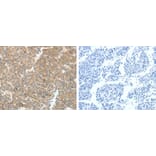 VEGFA Antibody from Signalway Antibody (31274) - Antibodies.com