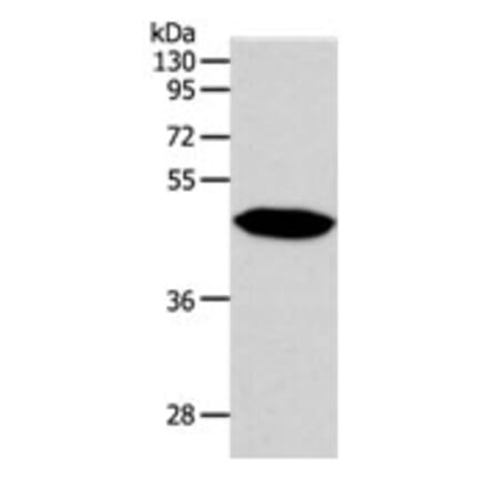 NPY1R Antibody from Signalway Antibody (31282) - Antibodies.com