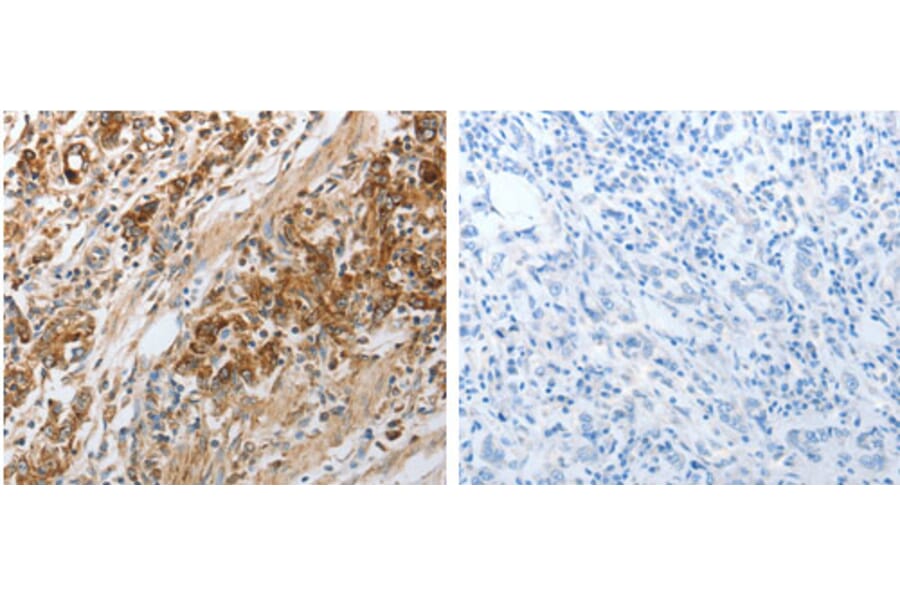 NPY1R Antibody from Signalway Antibody (31282) - Antibodies.com